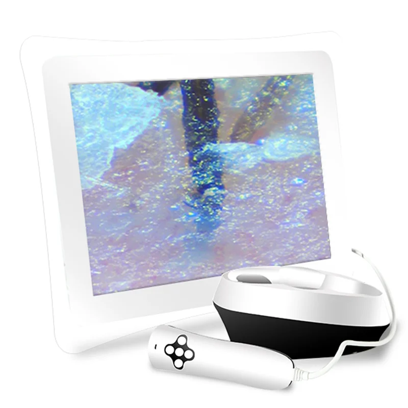 3D Smart 15-inch Screen Smart Networking Portable Beauty Apparatus Hair Facial Skin Test Skin Analyzer