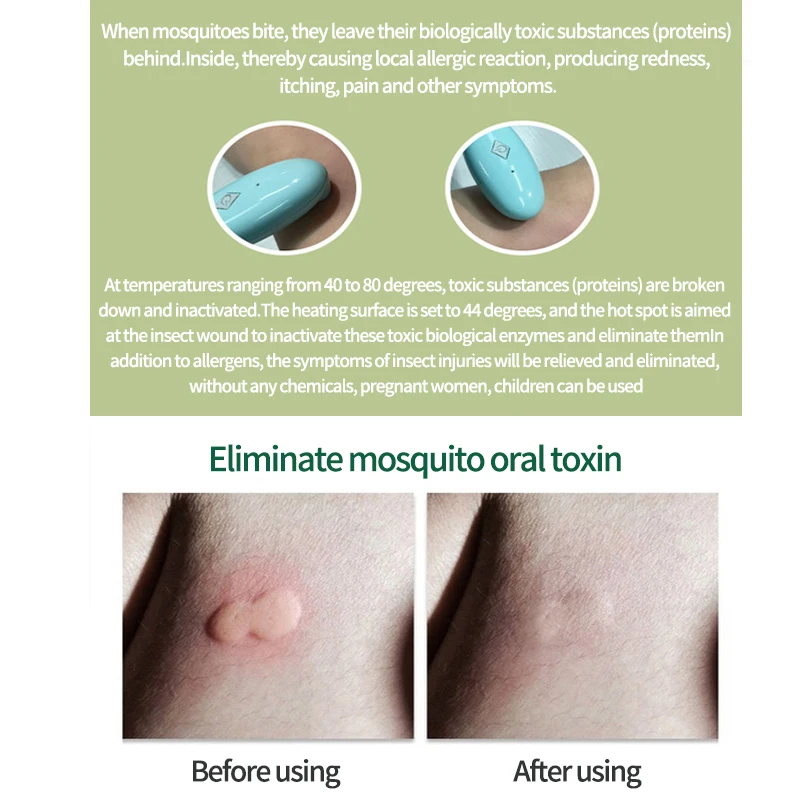 anti itching mosquito insect bite remover healer powered by mobile phone