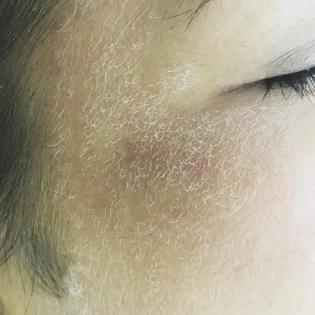 
2021 hair bleach laser beauty machine 