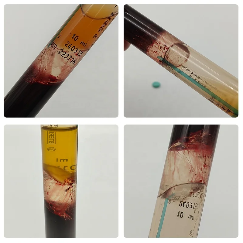 OEM Pyrogen Free Triple Sterile PRP Tube With Gel