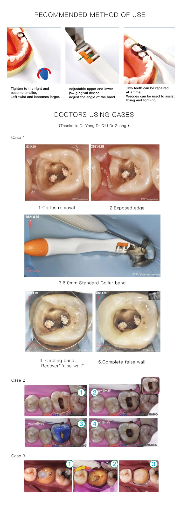 Лучший продавец стоматология легко сделать матрицу для зубной начинки