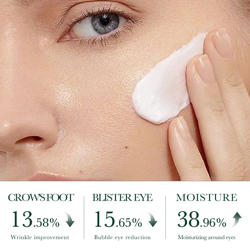 SADOER Oil-control Acne Mark Fade Herbal Natural Tea Tree Cream Anti-acne Smoothing Pimple Repairing Facial Cream