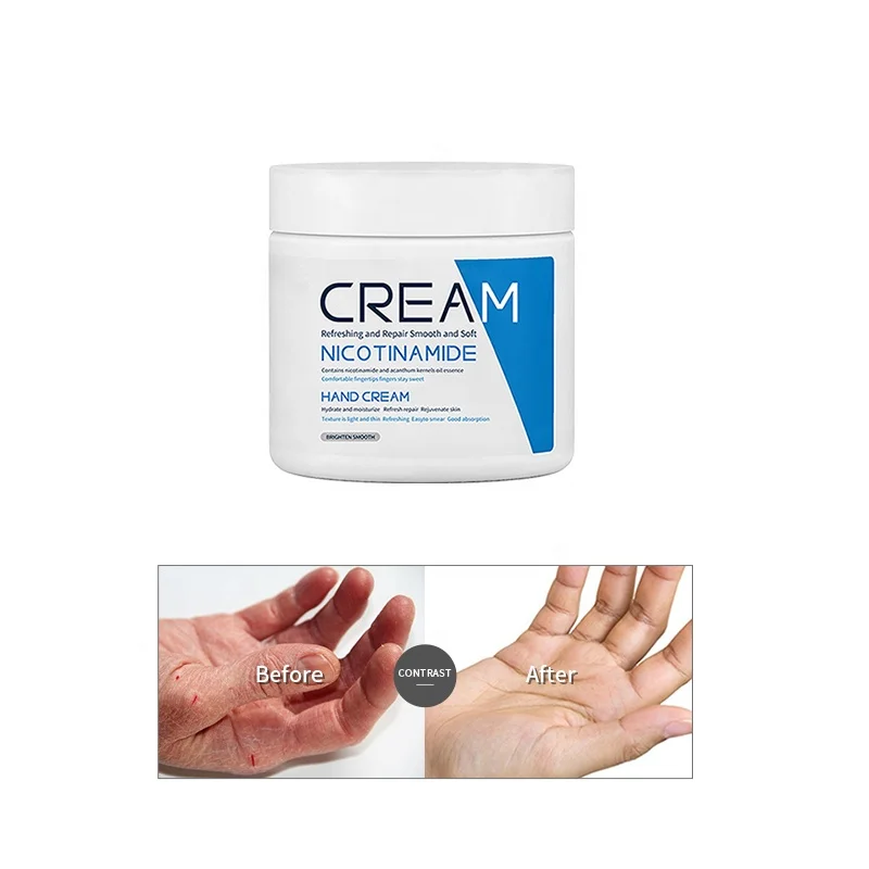 Отбеливающий Осветляющий укрепляющий крем для рук против морщин никотинамид дешевый антисухий крем для рук по оптовой цене