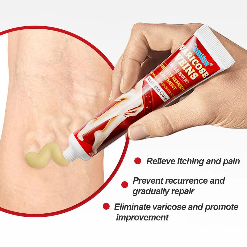 Sumifun New Varicose Veins Treatment Cream 100% Original Vasculitis Phlebitis Spider Pain Relief Ointment Medical Plaster