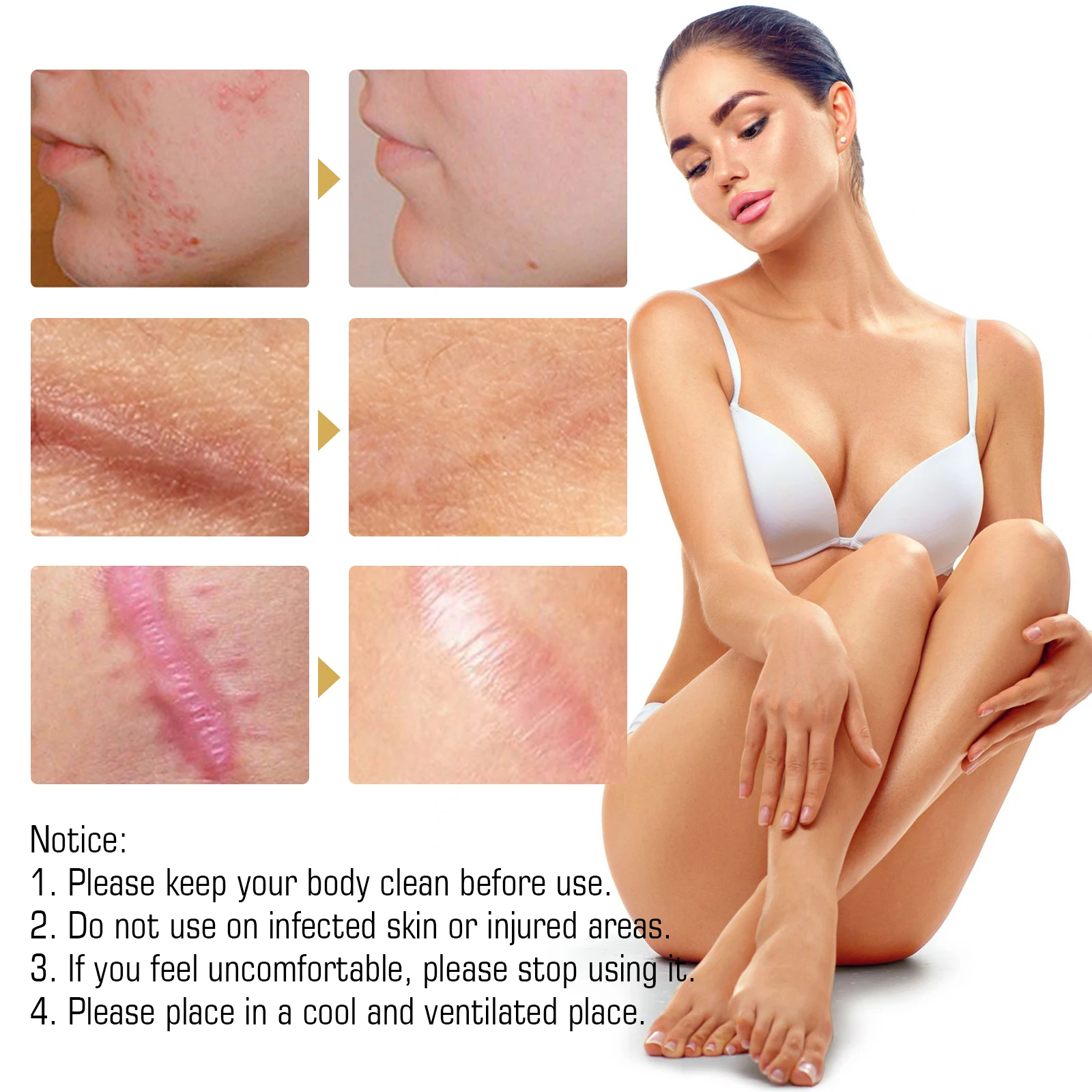 Hot Selling Natural organic fade Caesarean scar surgery scar to burn marks repair and smooth skin scar essential oil