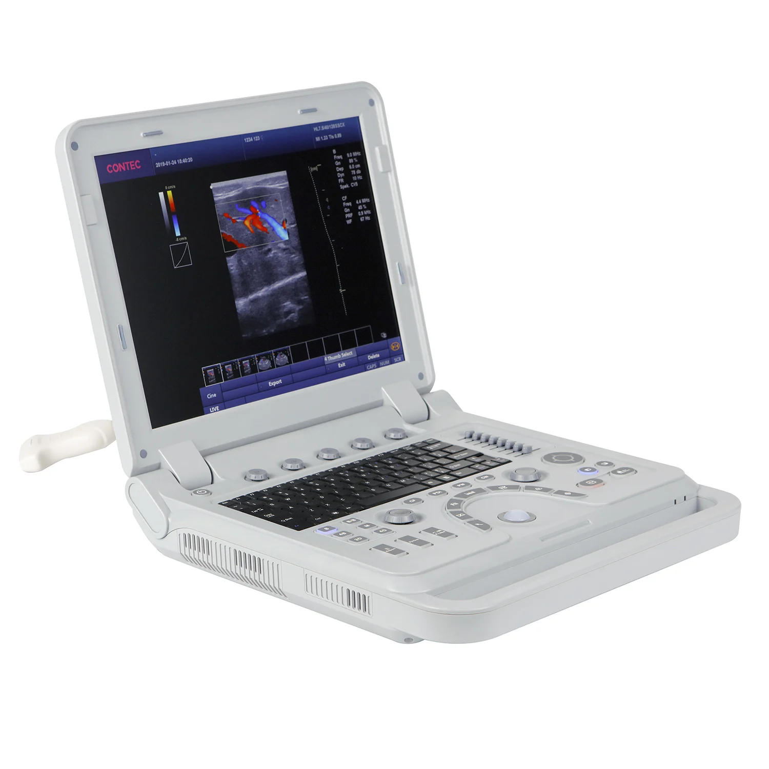CMS1700A Low Price Laptop USG Scanner 2D Portable Ultrasound Machine Human Pregnancy USG  Probe