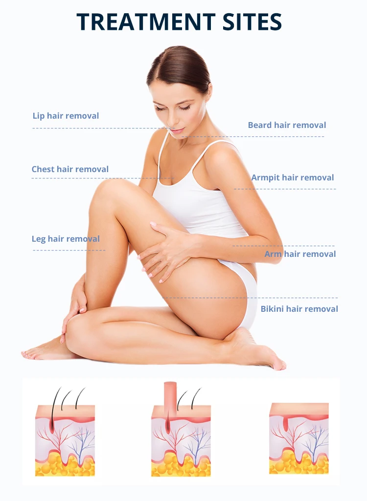 Promotion Price Portable Painless Triple Wavelength Diode Laser Hair Removal For Dark Skin