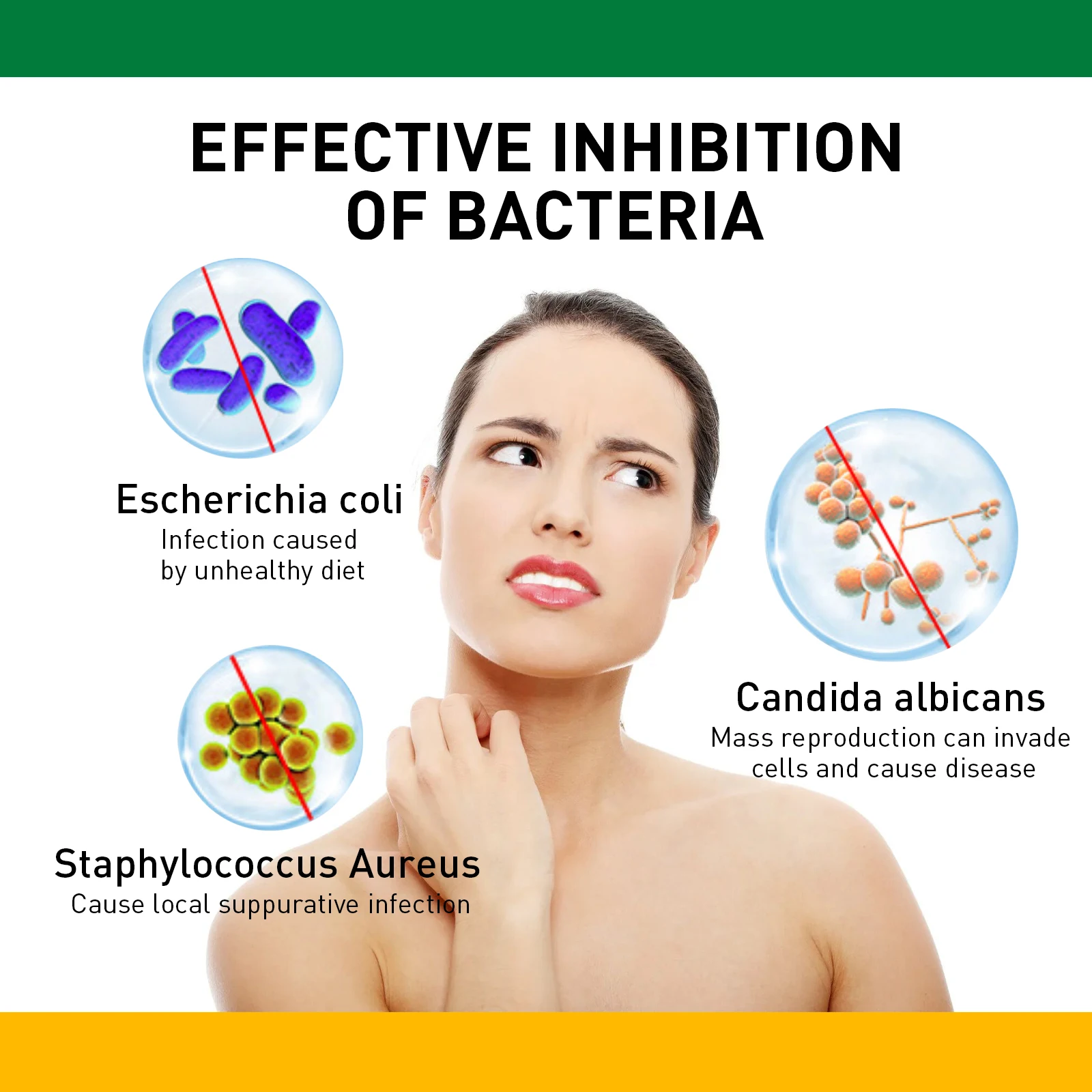 Custom logo Herbal Bacteriostatic Cream Psoriasis Dermatitis Ointment Anti-itching Skin Problems Antifungal Cream