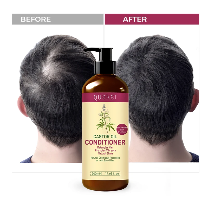 Qquaker Oem Organic Black Castor Oil Shampoo For Anti Hair Loss Hair Care Products Bundle Shampoo For Fine Hair
