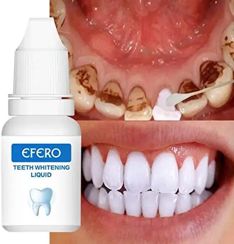 OEM Yellow Stains Teeth Treatment Smoke Coffee Plaque Dental Tools Oral Hygiene Remove White Tooth Care Teeth Whitening Essence