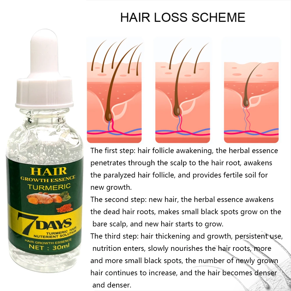 Private Label Natural Organic Vegan Treatment for Bald Hair Serum Wholesale Herbal Anti Hair Loss Boosting Hair Growth Oil