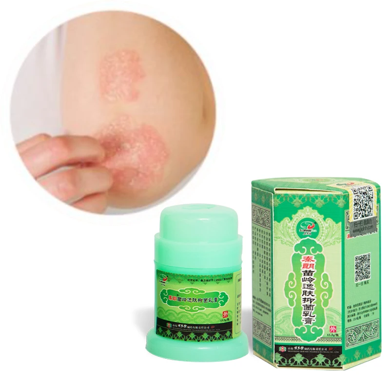 Wholesale Chinese Herbal Acne Antibacterial Ointment Manufacturers OEM Supply Daily Use for Body Skincare for Adults
