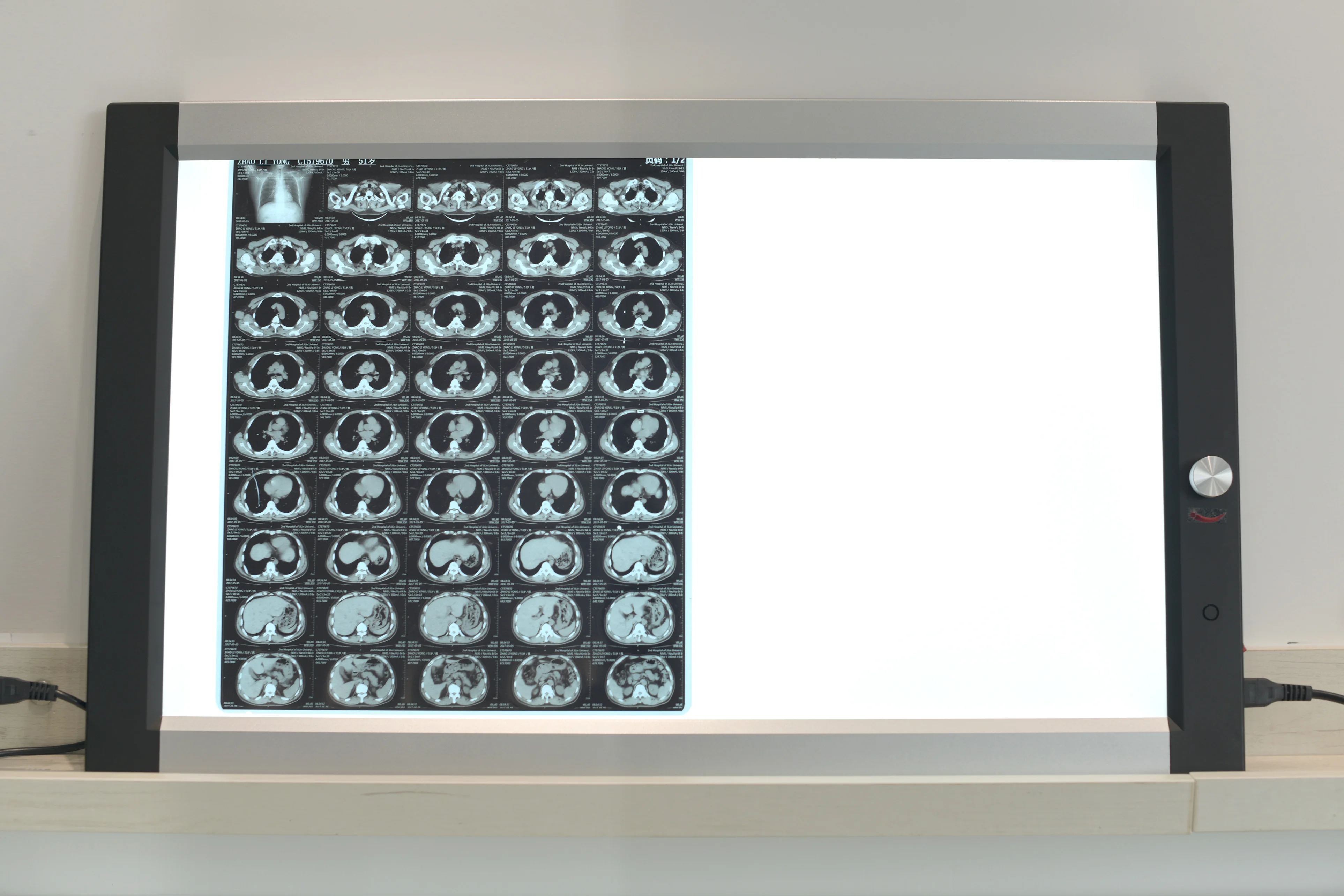 Micare DQ-2B 60w led double viewer  Hospital special orthopedic heart center X-ray source examination lamp