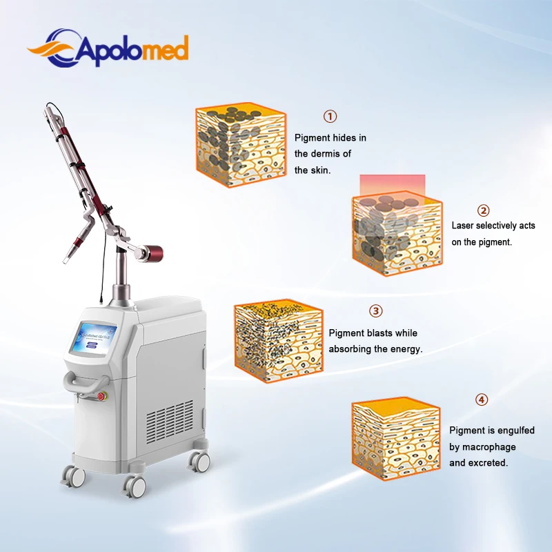 EO q switch 1064nm 532nm Nd Yag laser for tattoo removal vascular skin rejuvenation epidermal melasma treatment freckles
