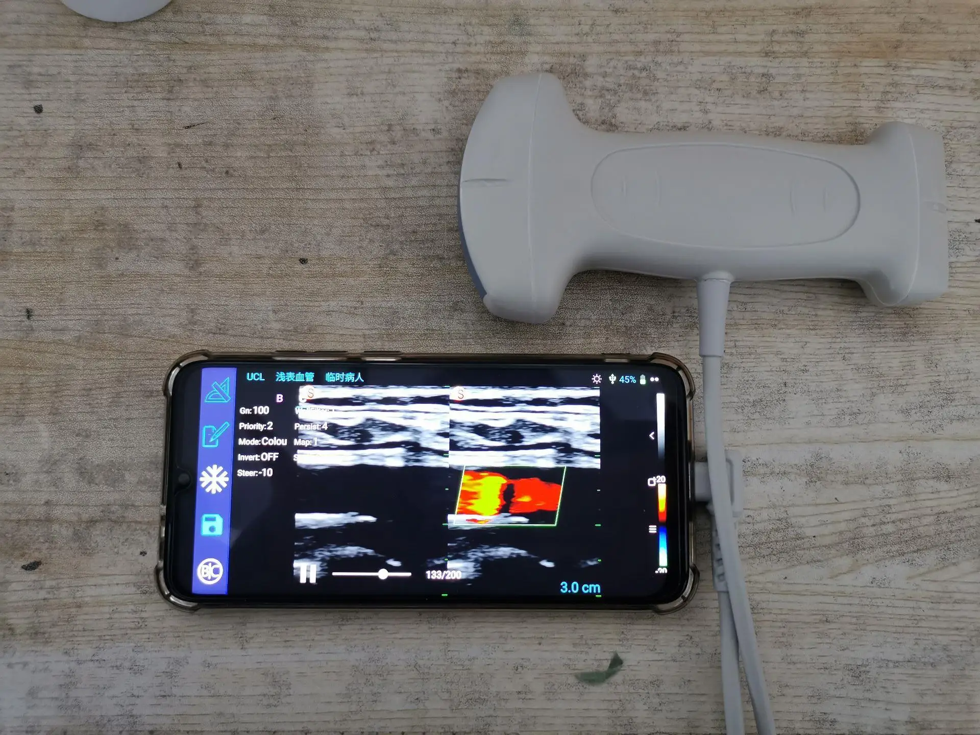 Двойная головка Портативный usb Ультразвуковой допплер
