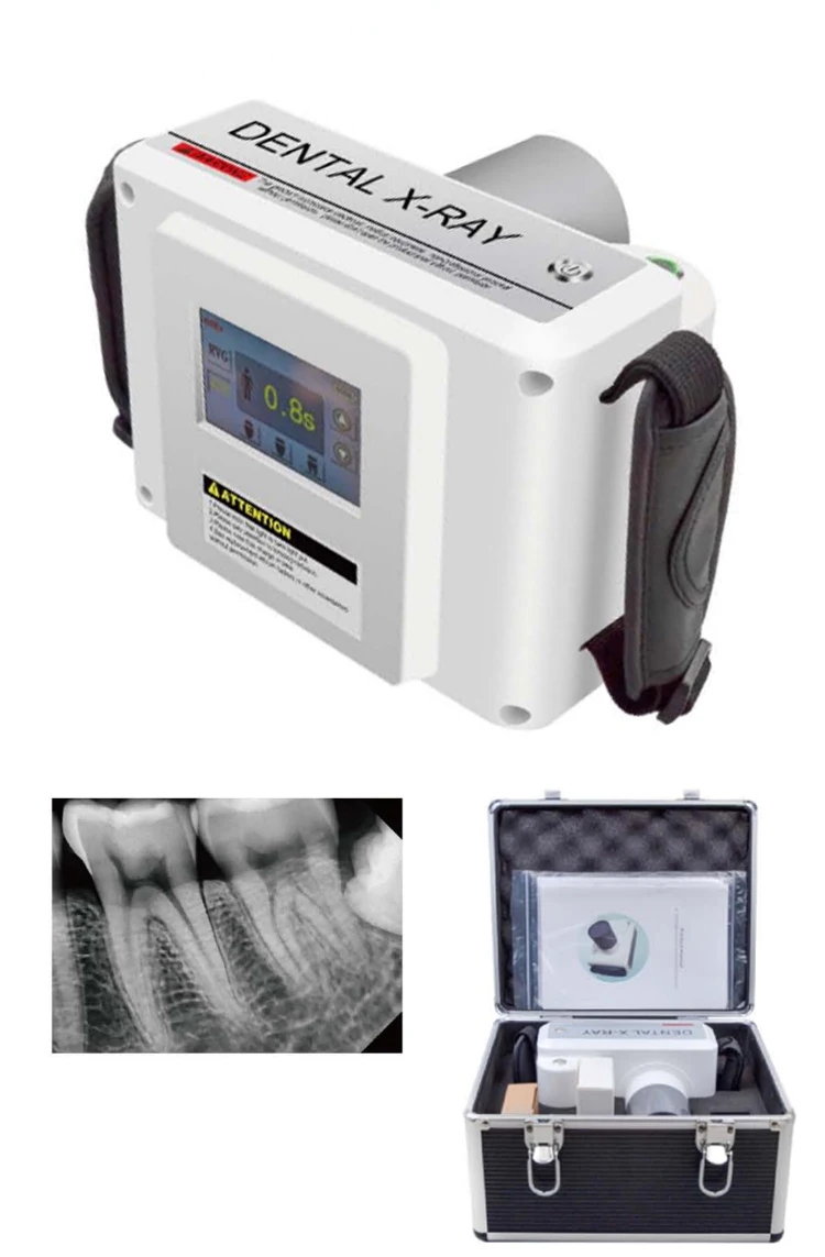 Portable-x-ray_03