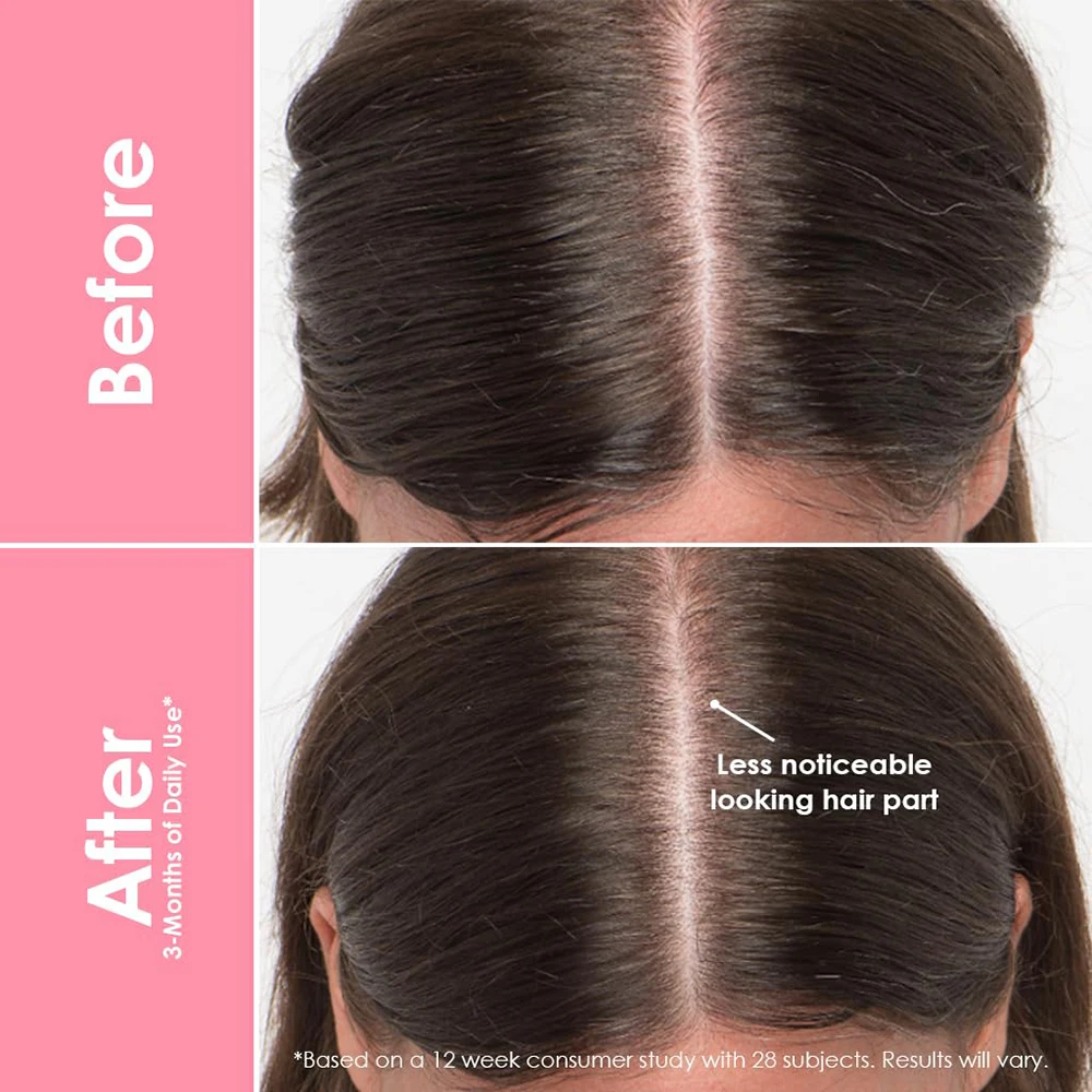 Private Label Support Skin Health Natural Citrus Flavor Vegan Gummy Supplement Collagen Gummies