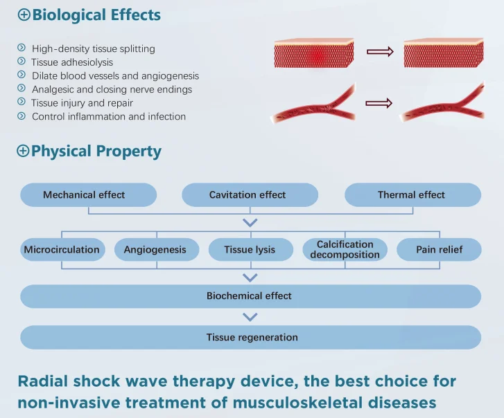 High Intensity Body Pain Relief Device ESWT Device Physical Therapy Equipment Shock Wave Machine
