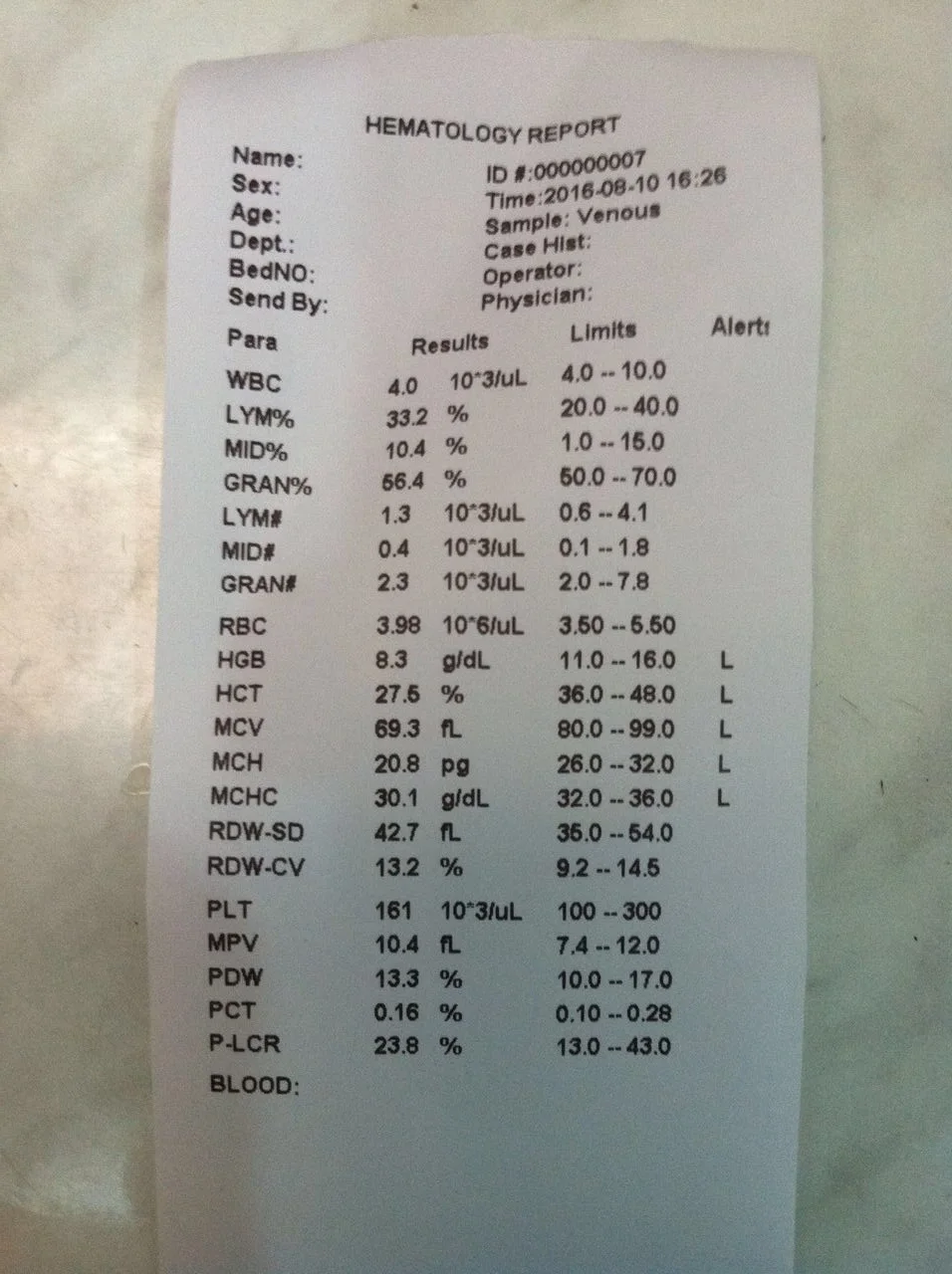 Full auto 3 parts difference hematology analyzer/double channel cbc test machine open to Mindray sysmex reagent system