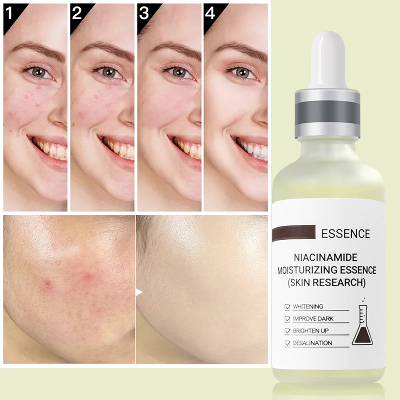 Essence Serum Niacinamide Serum Face Vibrant Glamour Hyaluronic Acid Facial Moisturizer Female Anti aging Serum