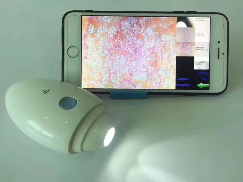 the most sold 2024 5g wireless hair scalp microscope skin analysis Tester Detector 1080p wifi skin scalp hair scanner analyzer