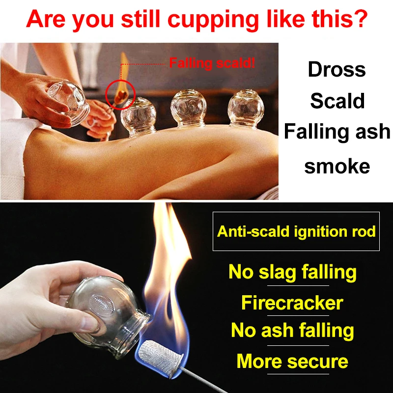 PZ Extension Special Ignition Stick Cupping Fire Stick Transparent Glass Cupping Dedicated Stainless Steel Ce 3 Year