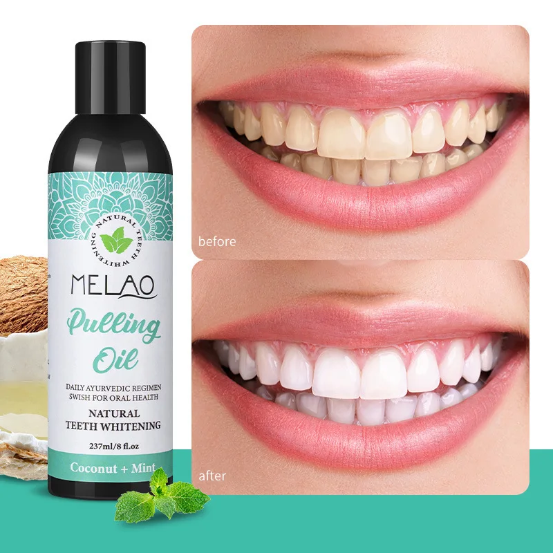 Customized OEM Factory 2 Coconut Oil Mouthwash Oil Pulling Mouthwash  Cleaning Gums Mouthwash