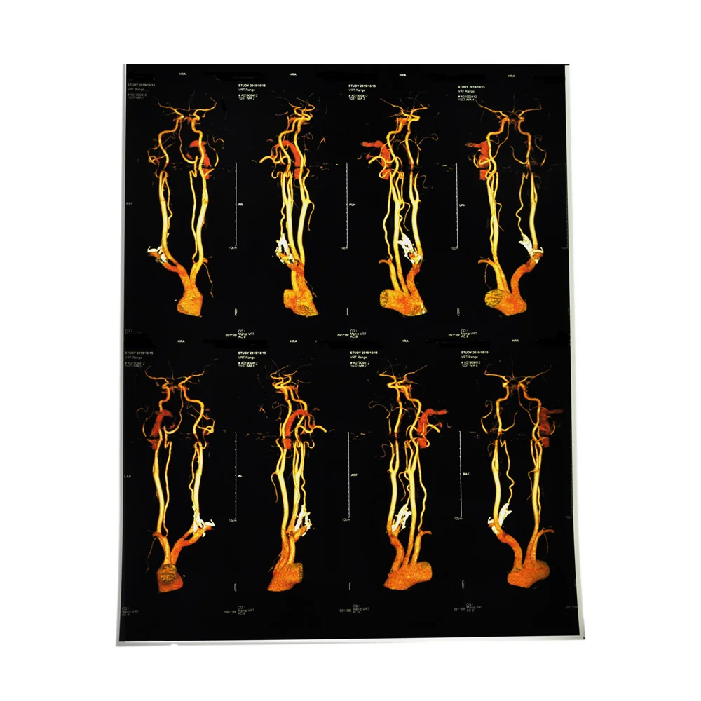 
Class I instrument classification medical radiology film for radiology endoscopic ultrasound 