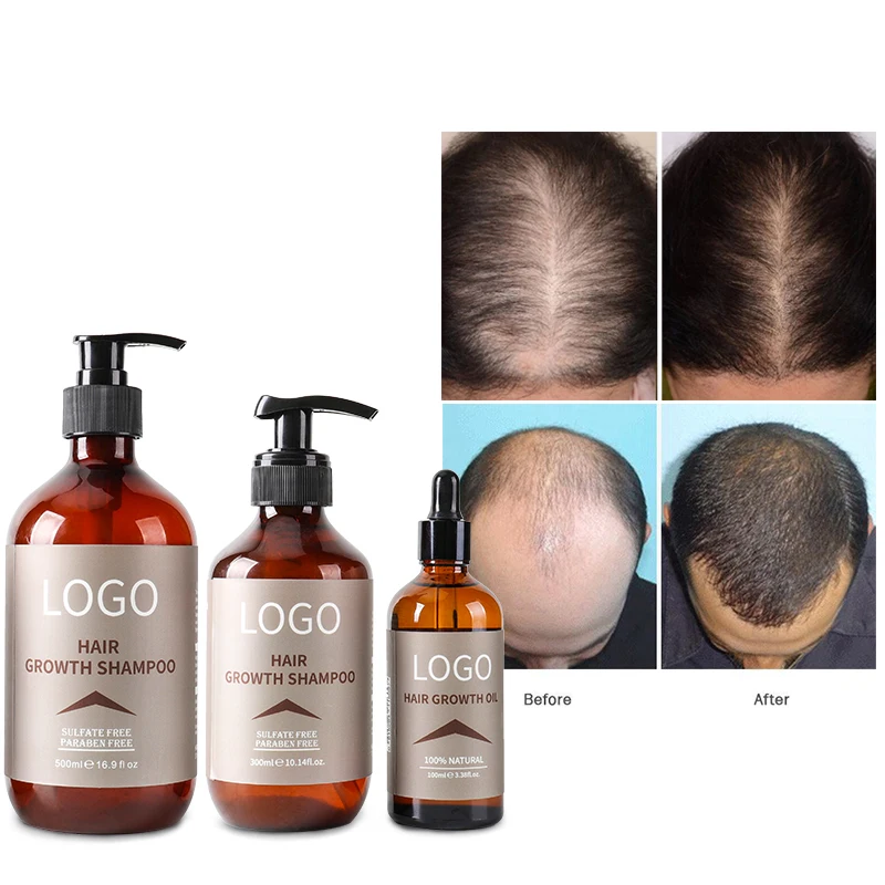 Private Label Batana Oil Organic Hair Regrowth 100% Natural Gginger Promote Hair Growth Shampoo OEM