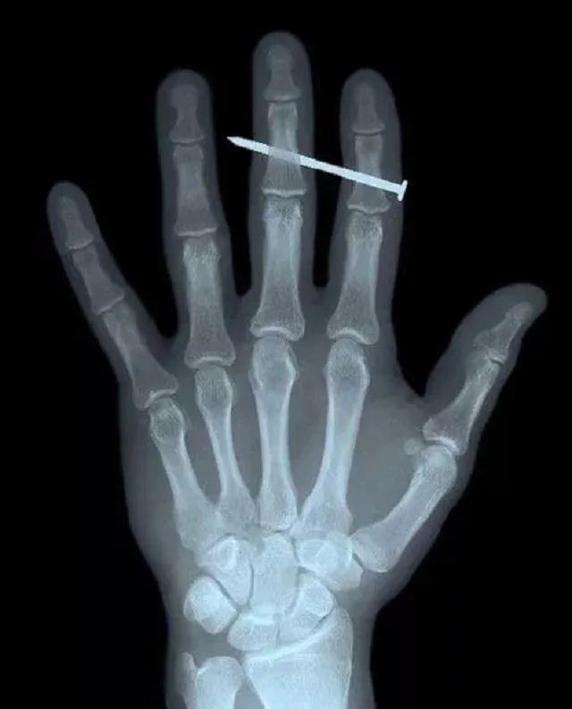 Inkjet blue printing medical x-ray film