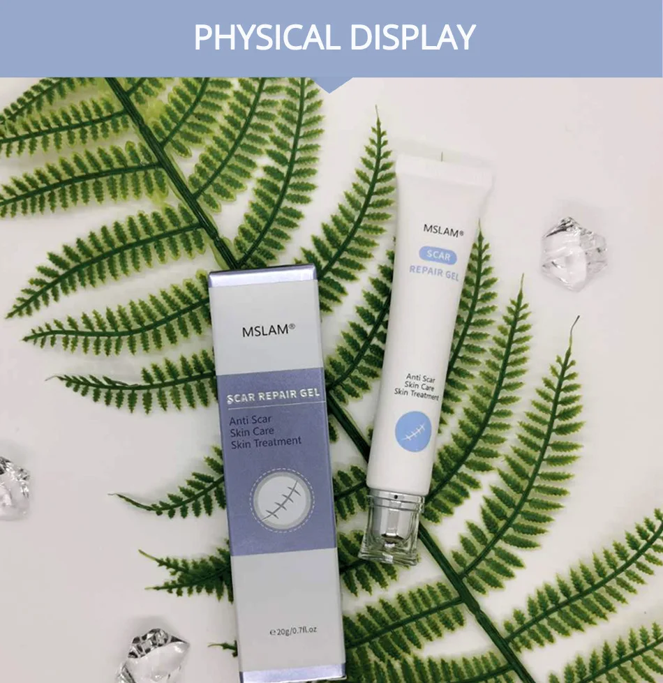 striae gravidarum cream