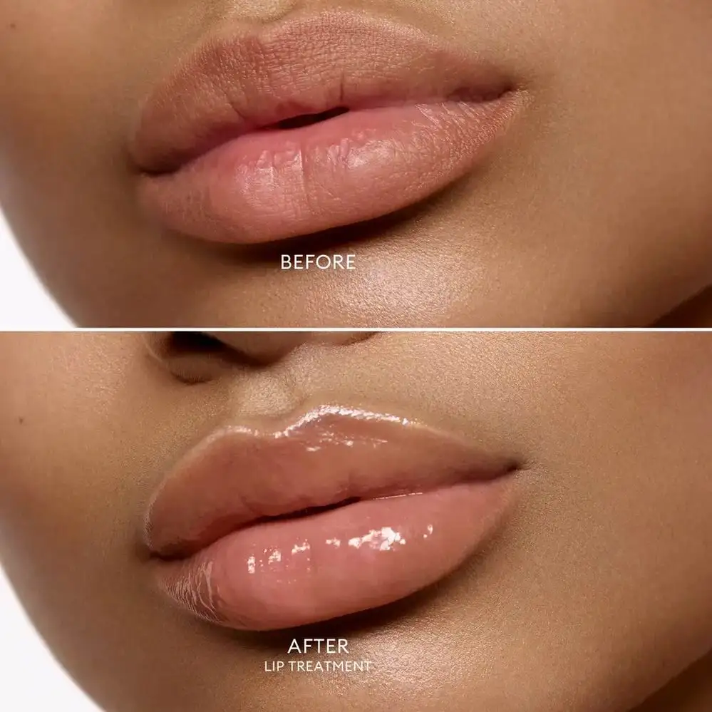 Multifunction Vegan Tinted Overnight Snail White Gold Lip Treatment Vegan Balm Private Label Hydrating Lip Treatment