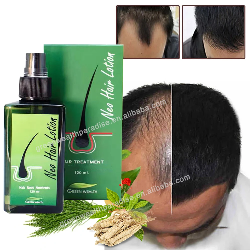 Neo Hair Lotion Made In Thailand Original hair Treatment  For Hair Loss Spray For Man Woman