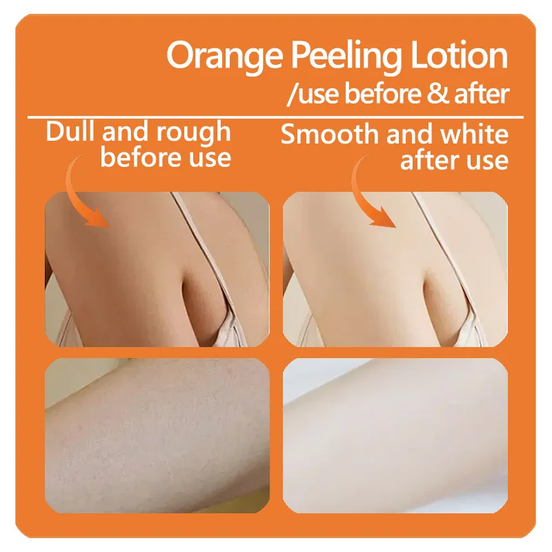 05 peel lotion