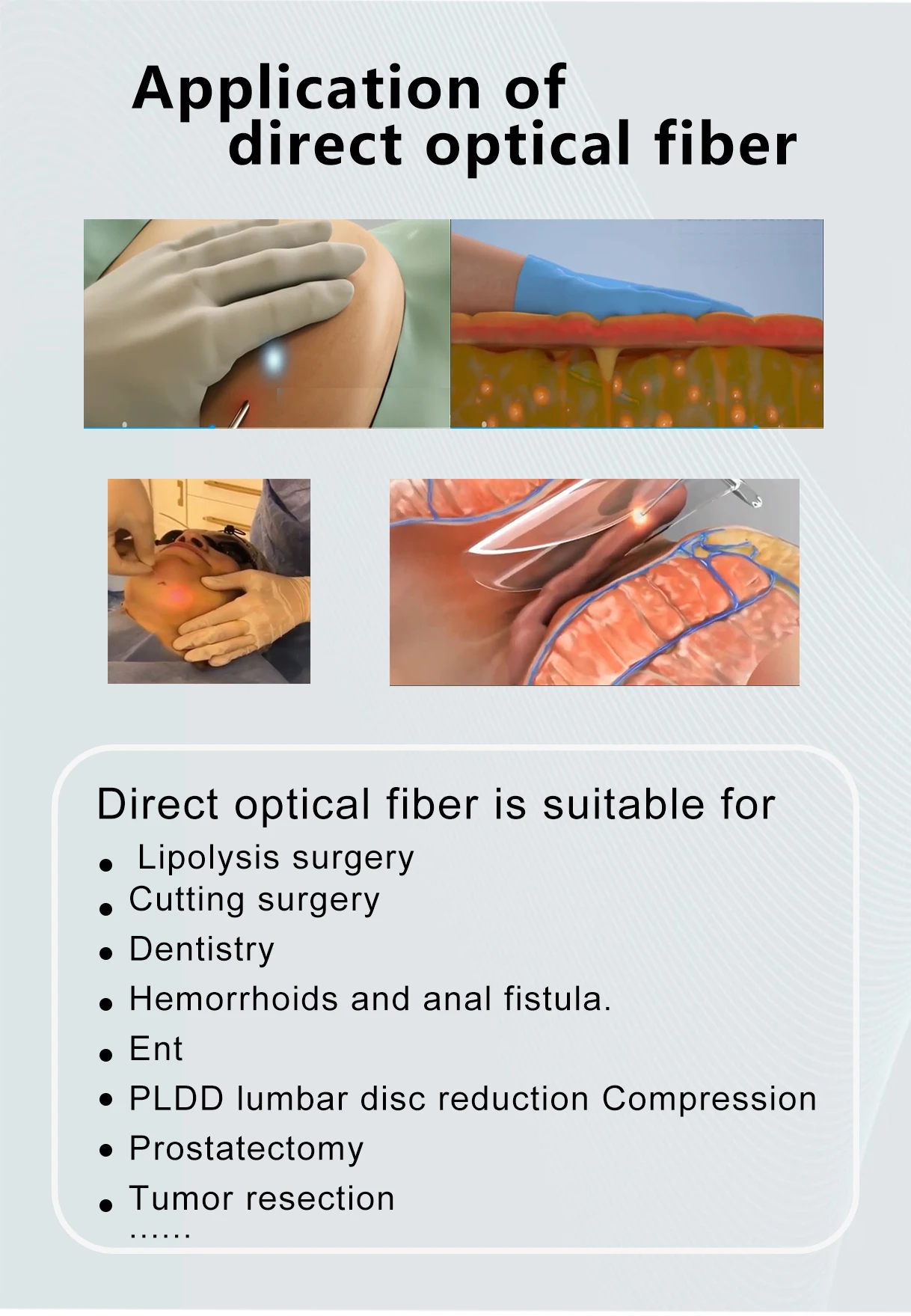1470direct fiber useful