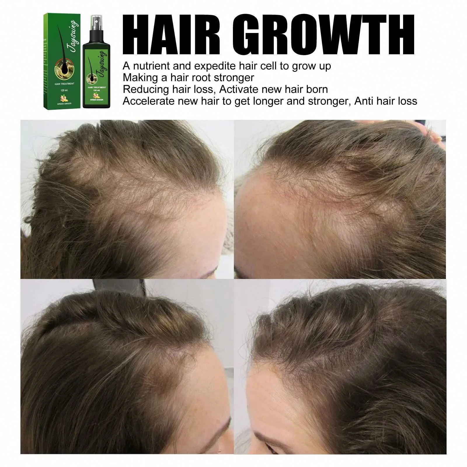 Hot Sale Natural Anti Hair Loss Hair Growth Scalp Care Treatment Ginger Germinal Serum Essence Oil
