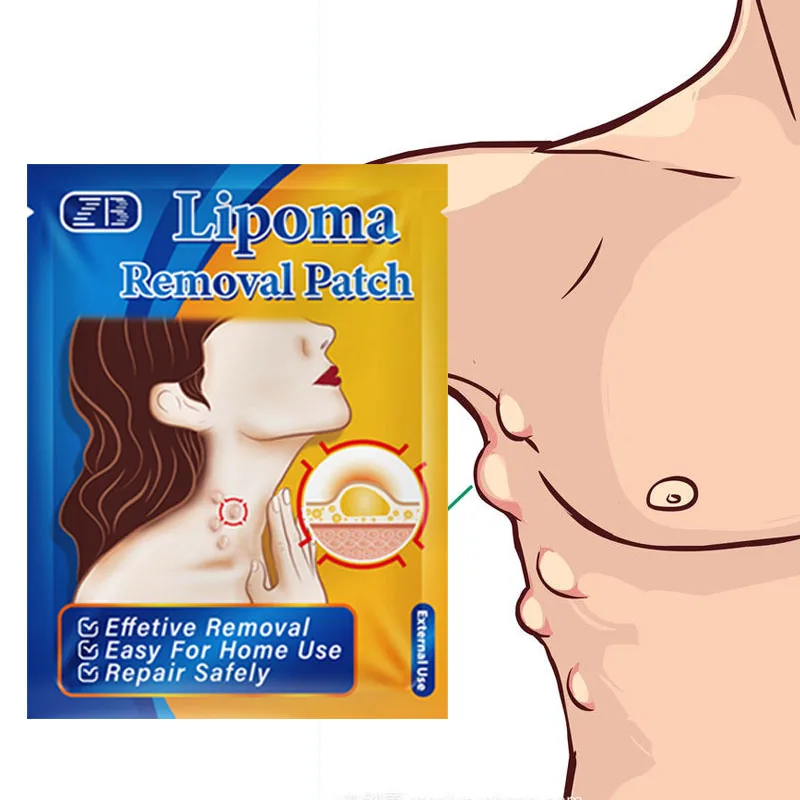 6 patches/bag Lipoma Removal Patch Removes Fibroids Lumps Pain Plaster Chinese Herbal Patches