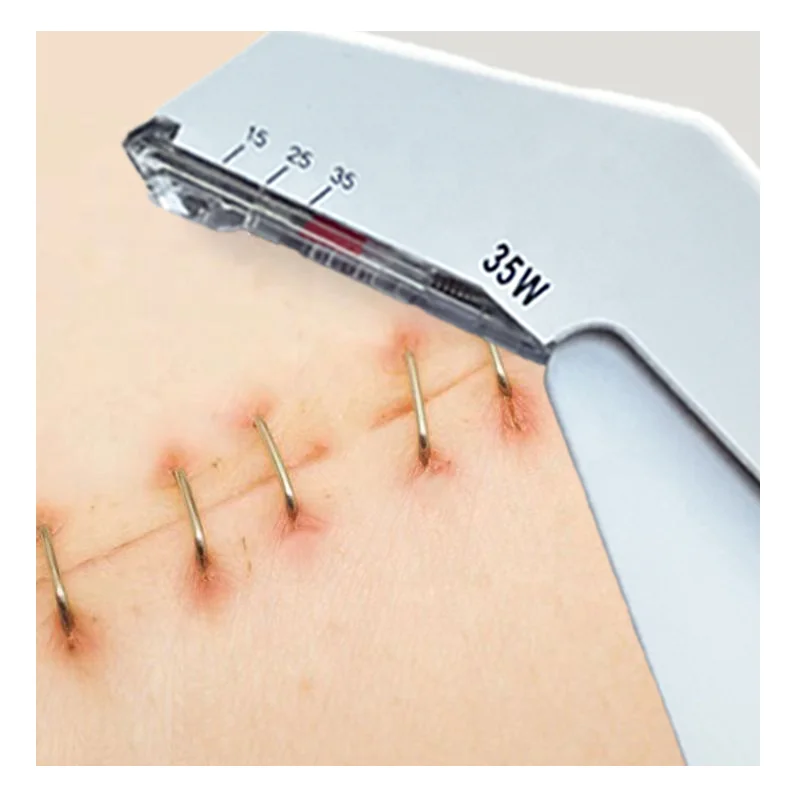 Disposable Medical Surgical Skin Stapler 35W Kit And Remover