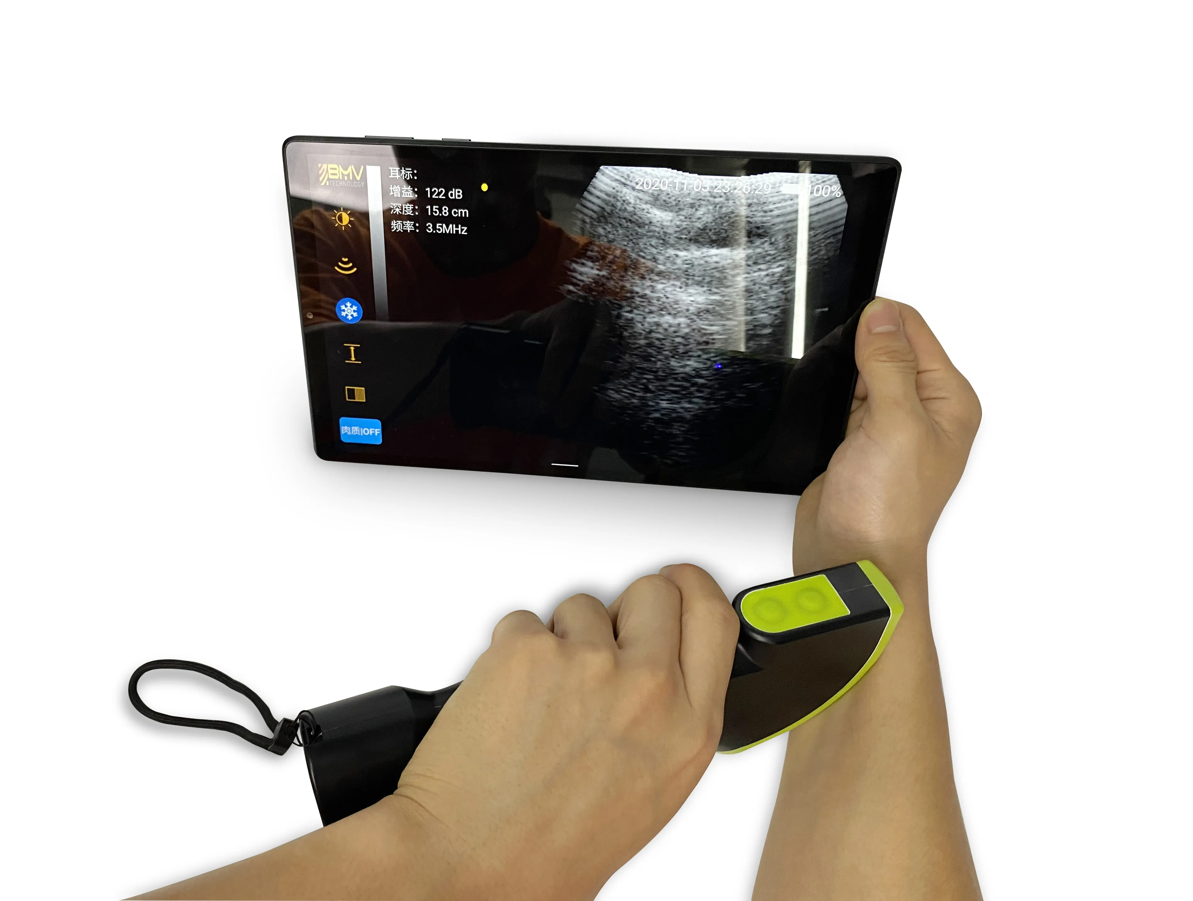 Farm Ultrasound Pig  sheep goat pregnancy diagnose Smart Probe Ultrasound Wireless Handheld Convex Ultrasound Machine Scanners