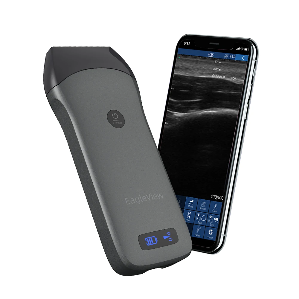  Weleaglue leview высокоинтенсивный сфокусированный медицинский аппарат беспроводной портативный ультразвуковой