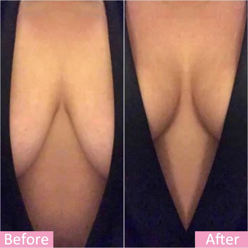 Plus size lift breast lift tape invisible boob tape for women