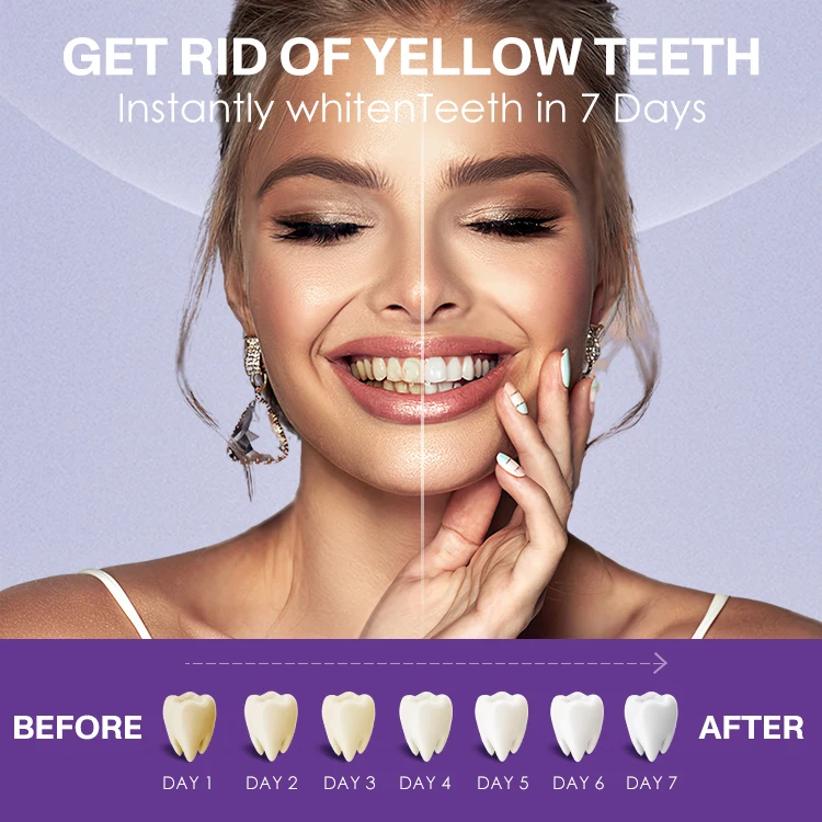 High Quality Tooth Whitening Bleaching Strips Teeth Stain Remover High Viscosity Teeth Whitening Home Strips 21 Treatments