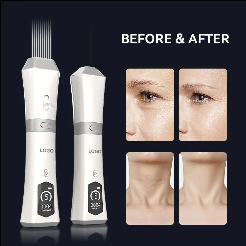 Portable Home Use High Intensity Focused Ultrasound Anti-aging Facial Skin Tightening Wrinkle Removal Face Lifting Device