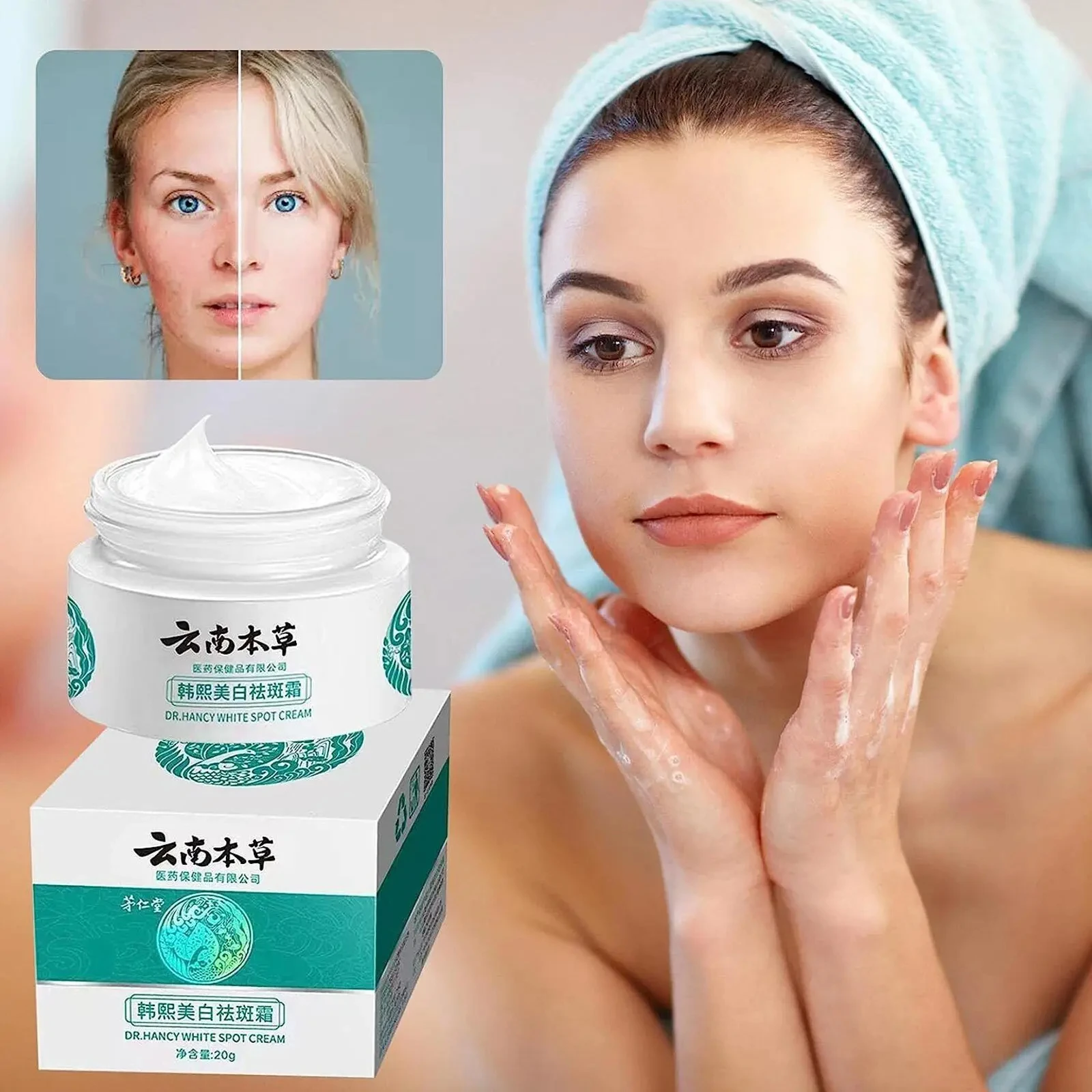 Yunnan Herbal Face Skin Care Whitening Anti Freckle Moisturizing Lightening Melasma Fade Spots Brightening Face Cream