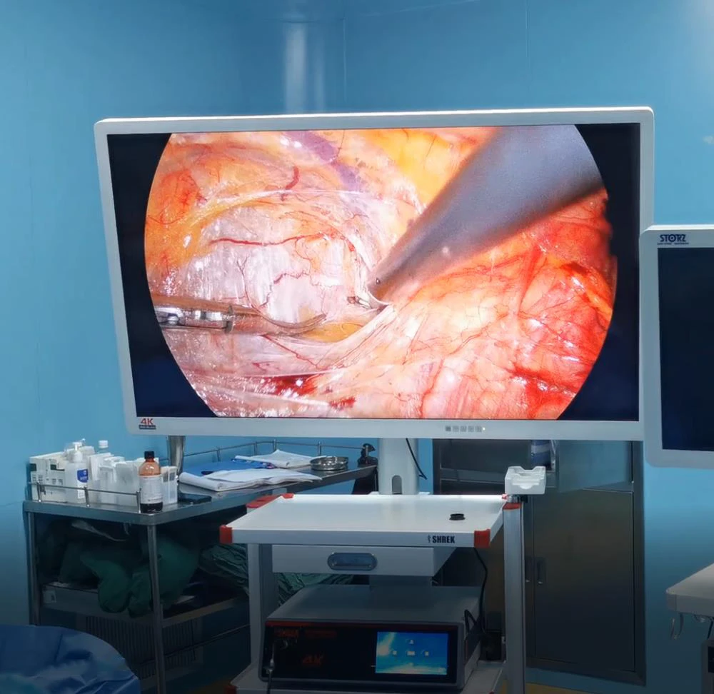 high quality 4k ultra medical endoscope camera from china