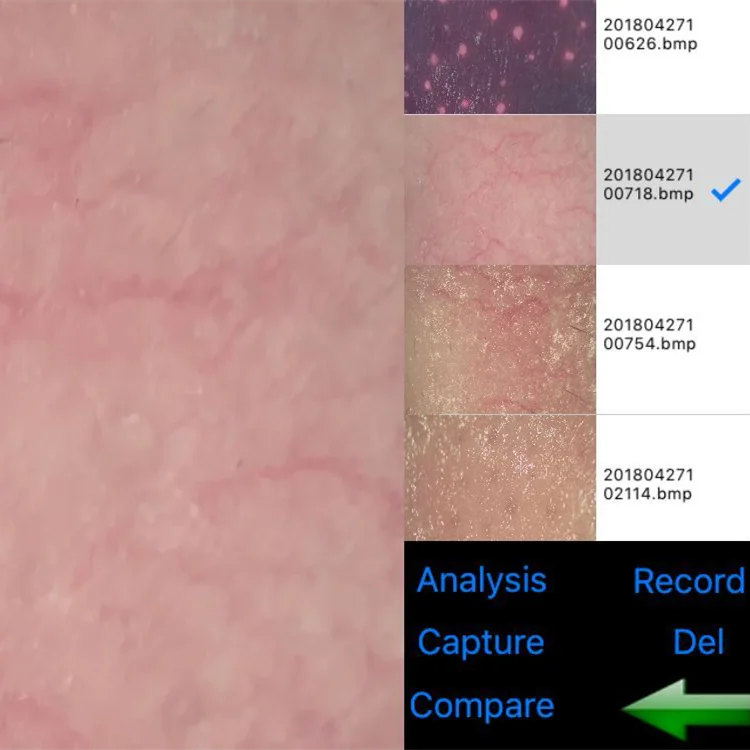 Wireless Smart Face Skin Type Camera WiFi UV Skin Scalp Analyzer Skin Moisture Tester