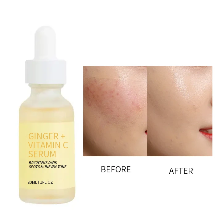 Private Label collagen anti-aging serum vitamin c ginger skincare dark spots acne turmeric serum