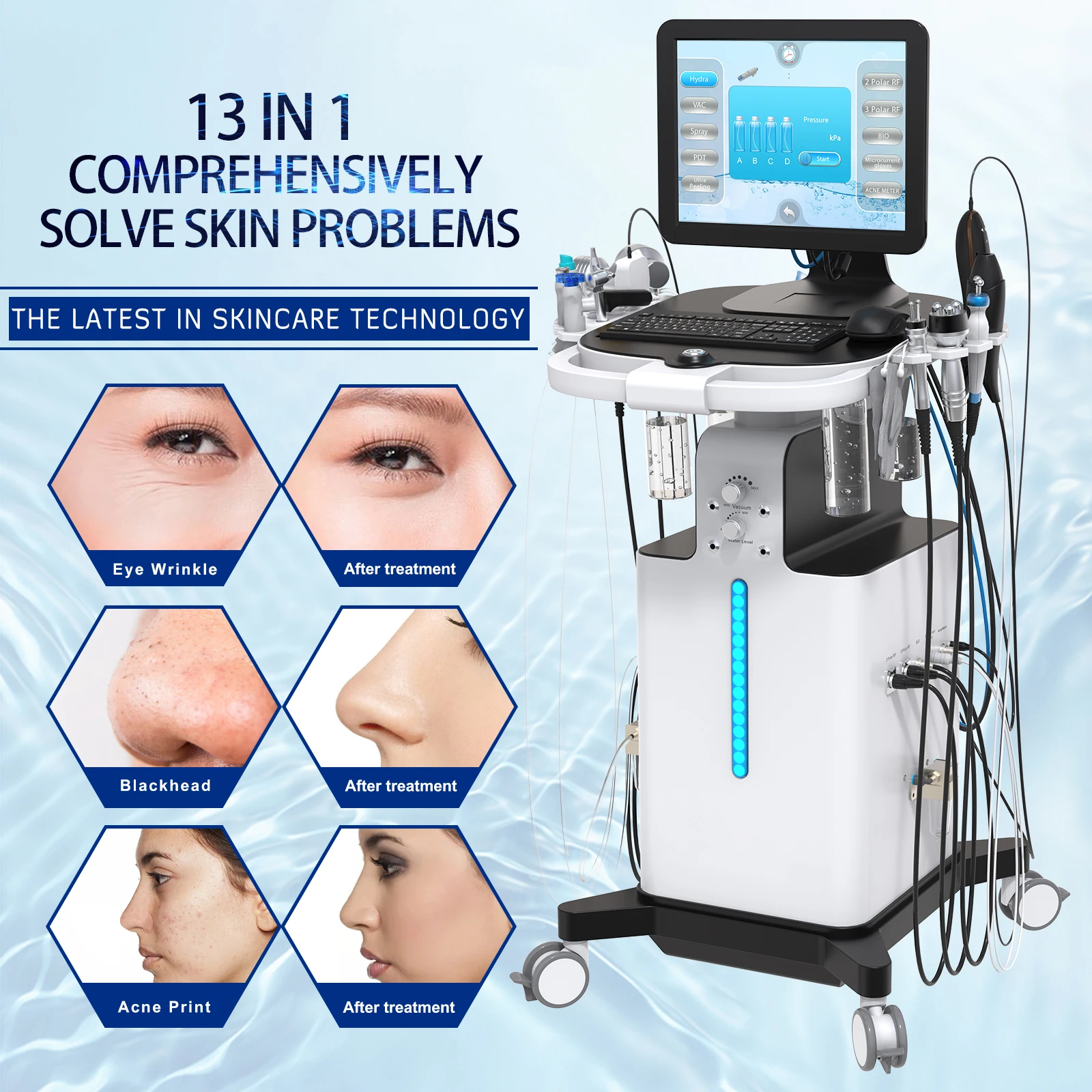 Newest 13 In 1 Oxygen dermabrasion Hydra Multi Function Facial Machine Hydro Crystal Microdermabrasion Facial Machine