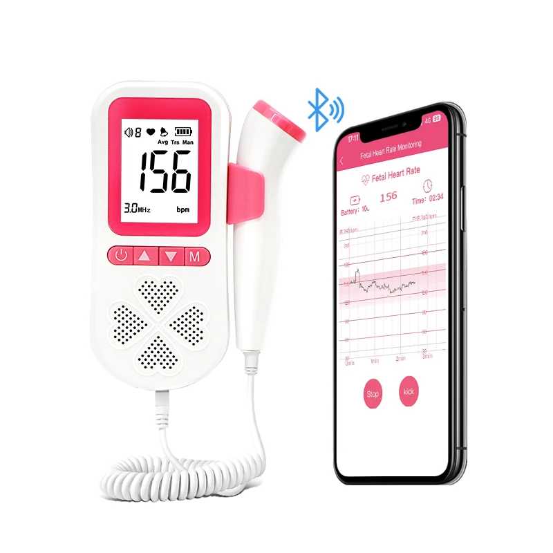 Remote Telehealth Record and Share Baby Heartbeat Monitor Fetal Doppler with App Mobile Phone Bluetooth Connect