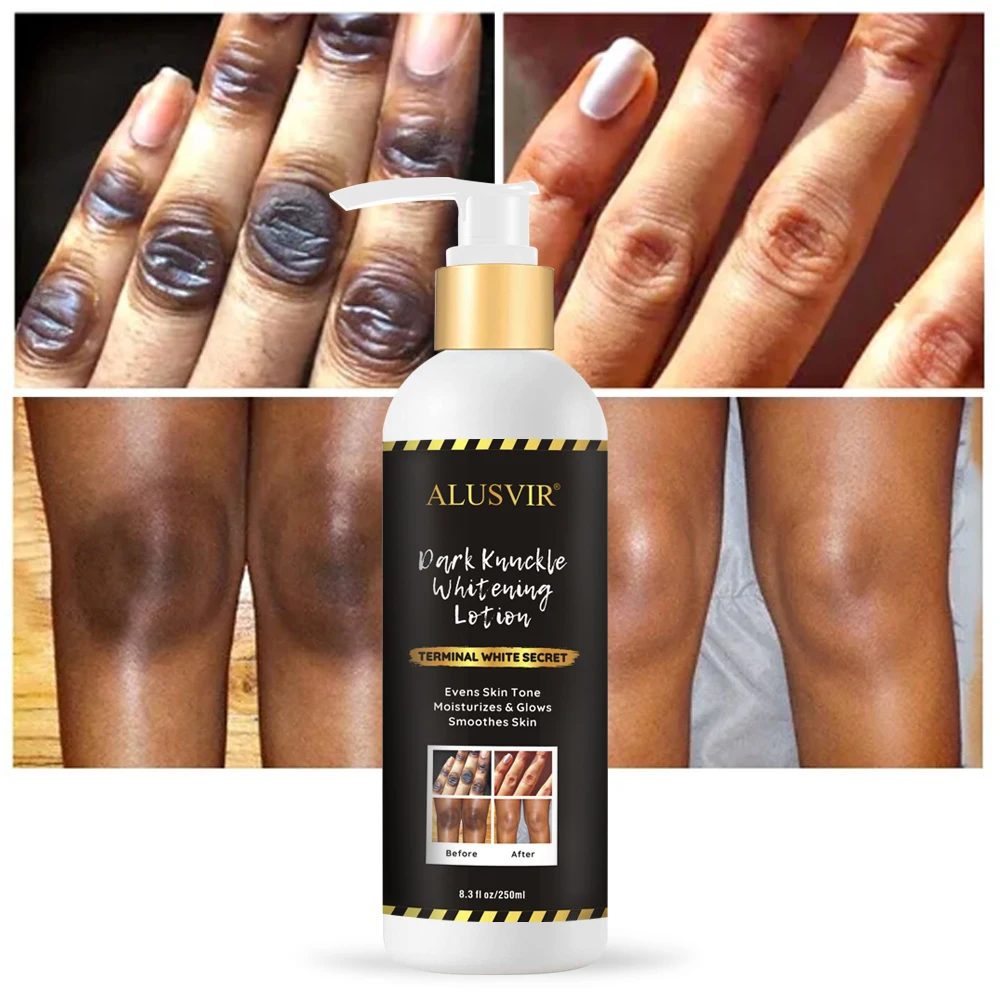 Private Label Skin Whitening Body Cream Strong Bleaching Products Dark Spots Remover Lightening Body Lotion Adults Female